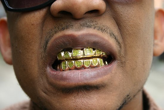 Una volta c’erano i denti d’oro….. ora c’è la truffa
