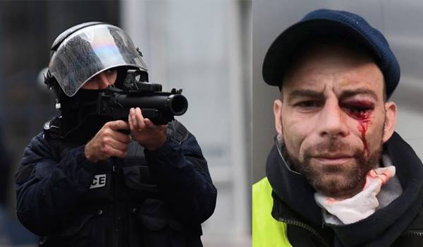 REPRESSIONE CHE NON “SI DICE” – La risposta ‘democratica’ al dissenso
