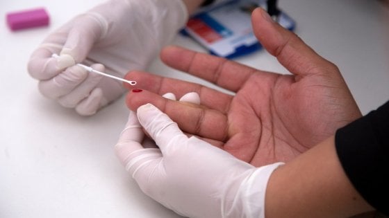 AIDS – Nascondeva la malattia, ha contagiato diverse donne. Morta la compagna