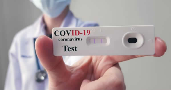 TEST COVID-19 – Gratuiti per tutti i medici e odontoiatri: l’Ordine di Messina amplia le disposizioni regionali