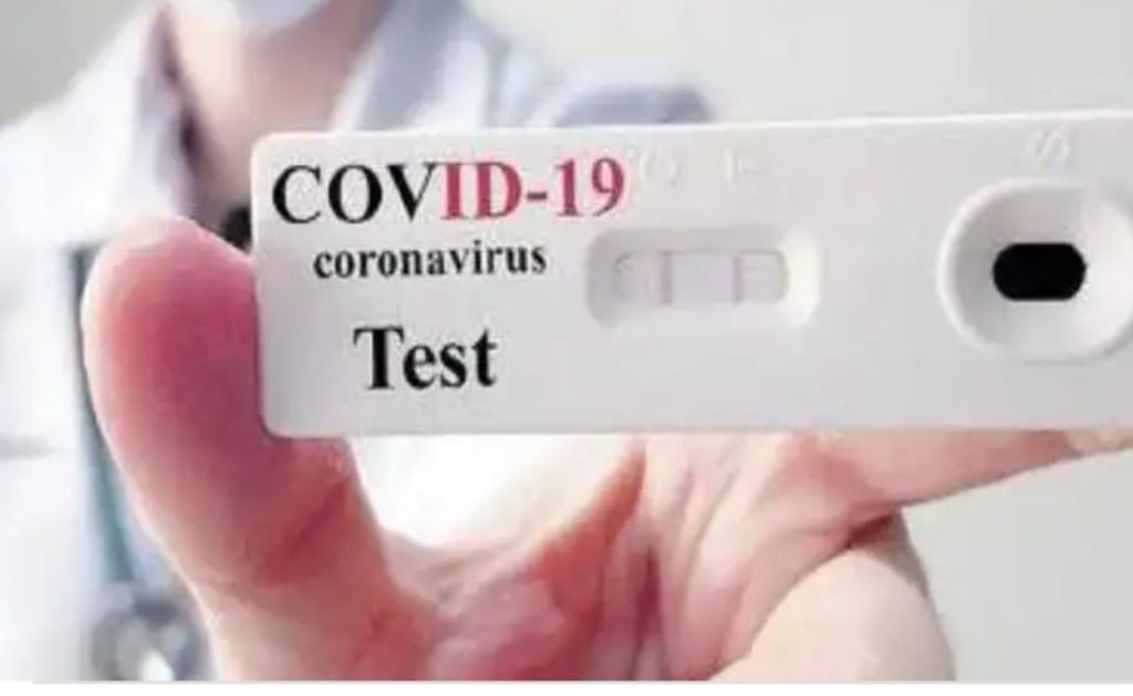 COVID TEST – E’ possibile farlo anche al laboratorio di analisi Santa Rita di Capo d’Orlando